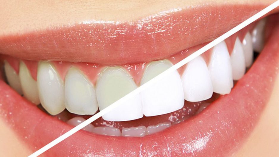 odontoiatria estetica