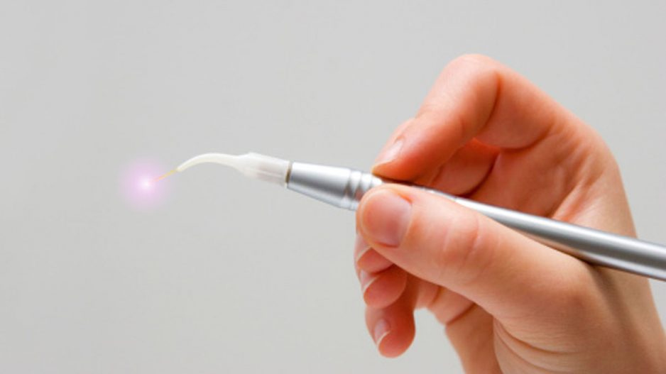 terapia laser dentista lembo