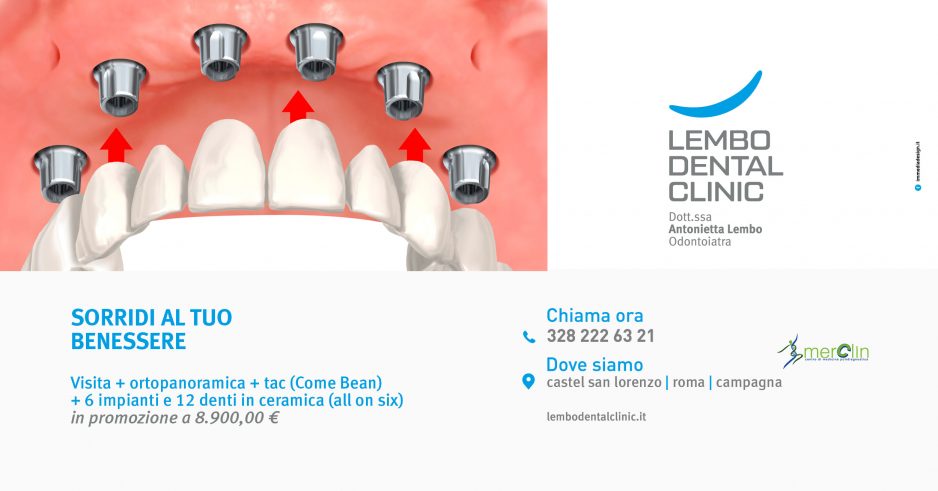 implantologia in promozione lembo